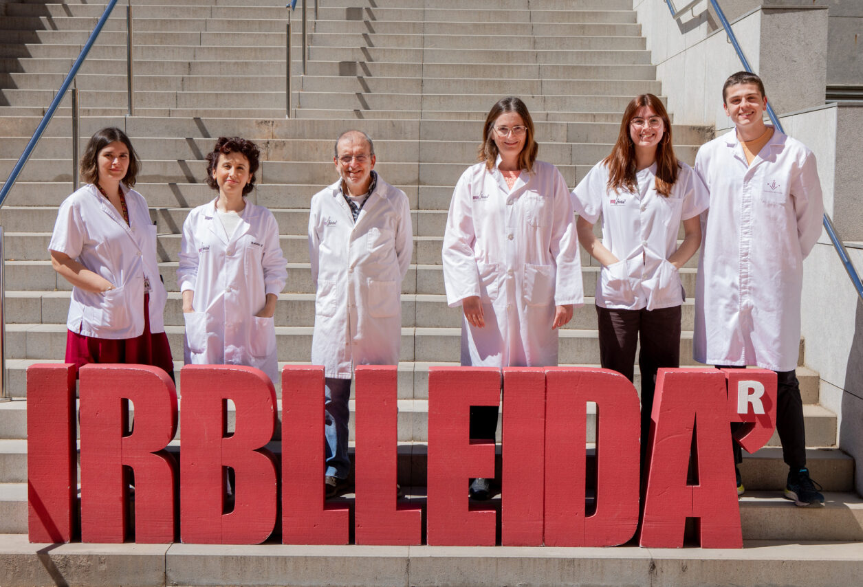 Grup Immunologia i Immunopatologia UdL-IRBLleida